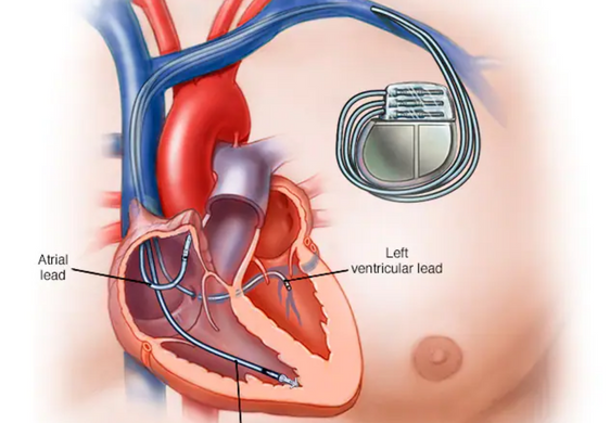 Dr. B. C. Kalmath – MD. D.M. D.N.B. (Cardiology)